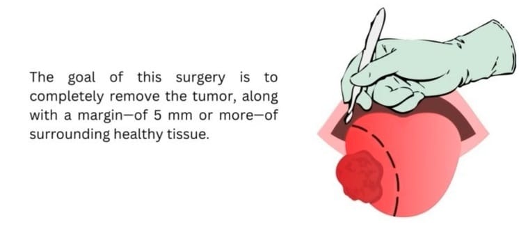 2023 Spectroscopy Application Challenge Winner Tumor