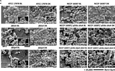 Blue Light Sensing BlsA-Mediated Modulation of Meropenem Resistance and Biofilm Formation in Acinetobacter baumannii