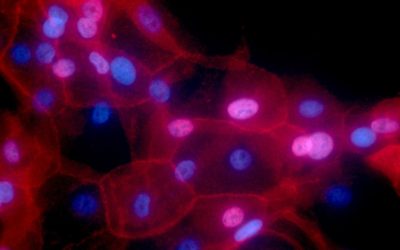 How Compact Spectrometers are being used in Cancer Research: Approaches to a Multifaceted Problem