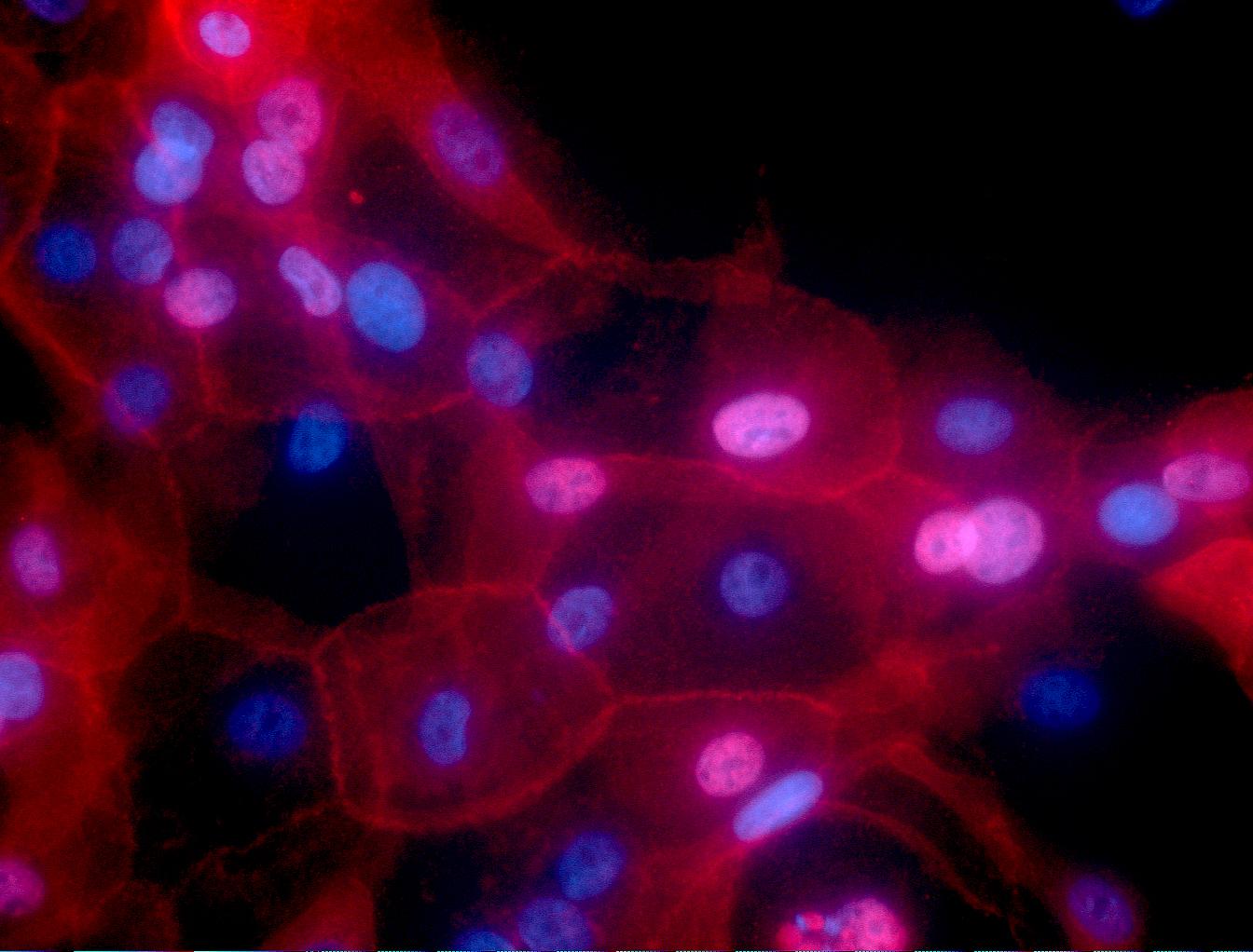 How Compact Spectrometers are being used in Cancer Research: Approaches to a Multifaceted Problem
